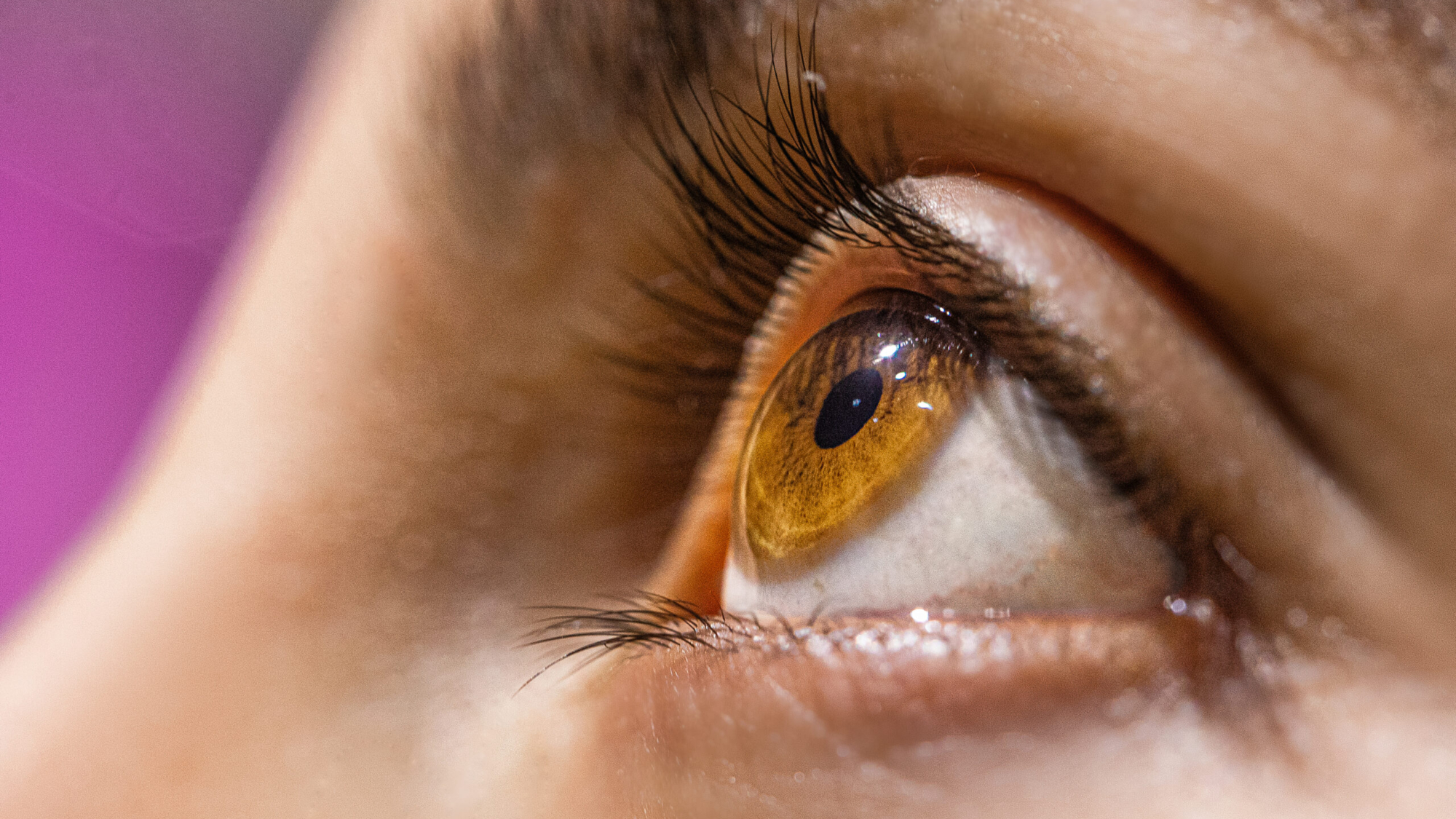 Retina Treatment in Ahmedabad